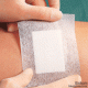 Curapor Wundverband transparent, steril, 7 x 5 cm (50 Stck.), 1 Packung