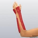 Delta-Cast Conformable Stützverband, 3,6 m x 5,0 cm, rot (10 Stck.)
